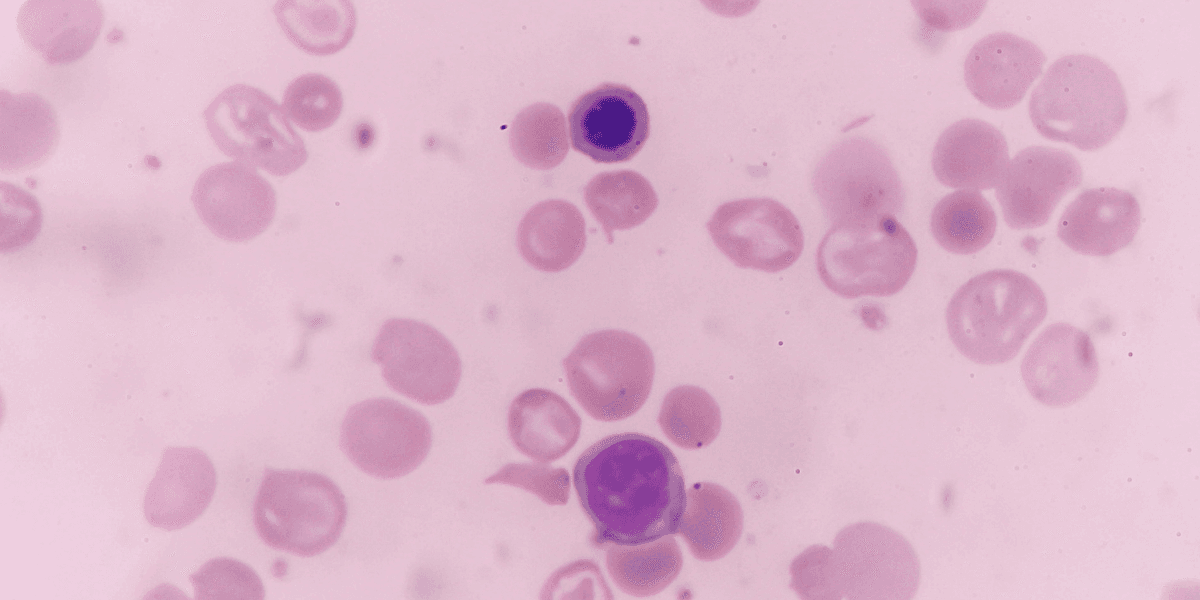 Microscopic view of blood cells showing red blood cells and a blue-stained cell.