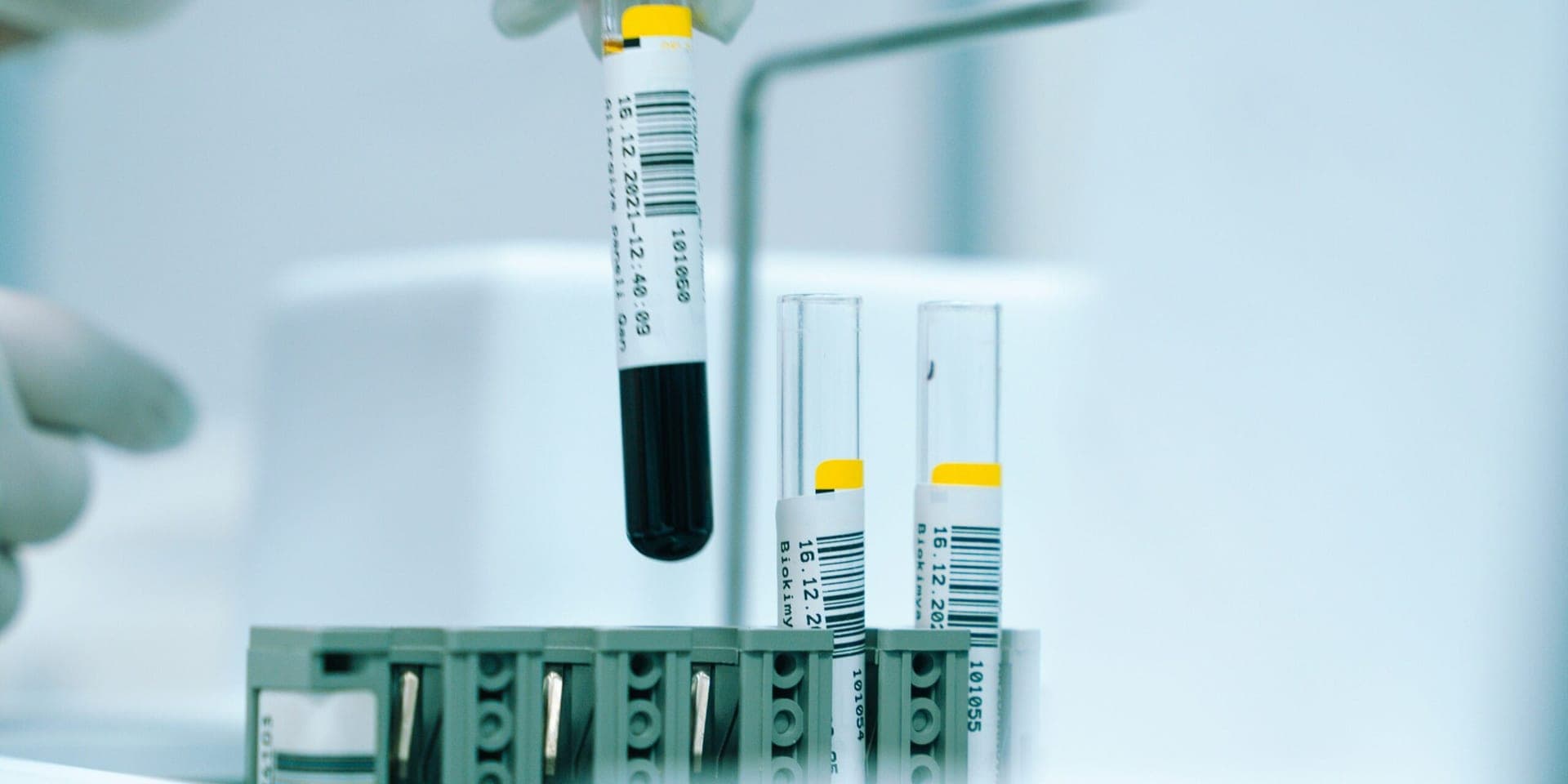NHS Introduces ‘Revolutionary’ Blood Test for Cancer Detection