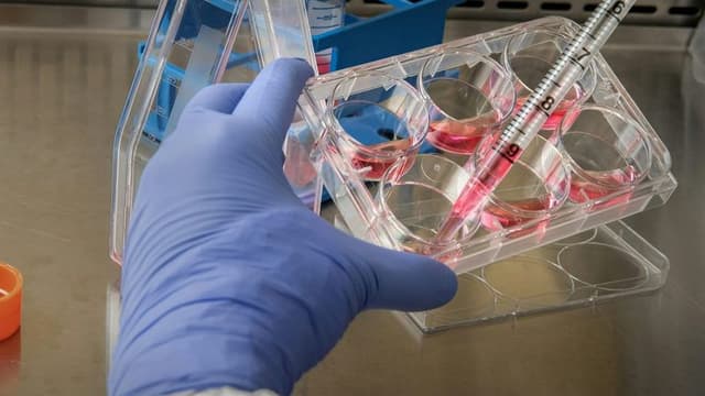 Early Stem Cell Trials for Parkinson’s Disease Show Safety in Phase I — Researchers Cautiously Optimistic