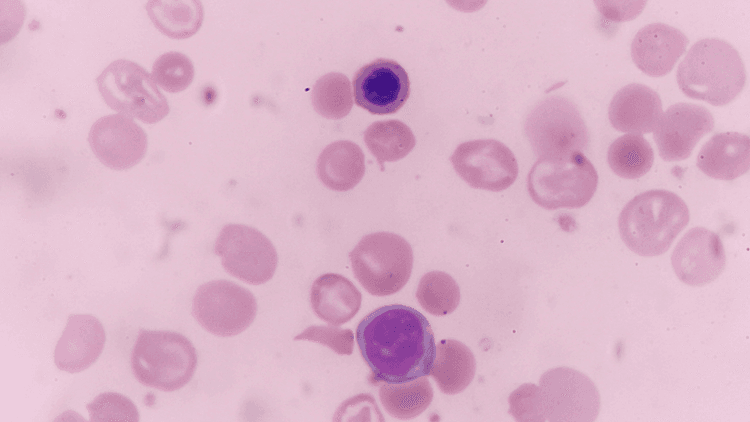 Microscopic view of blood cells showing red blood cells and a blue-stained cell.